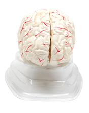 XC308 Human Brain with Arteries