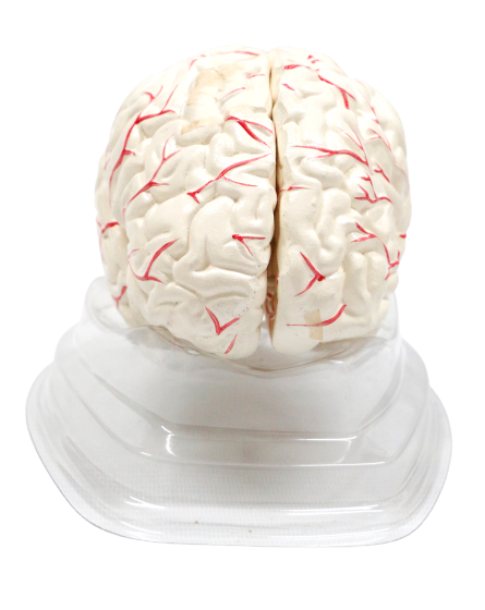 XC308 Human Brain with Arteries