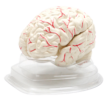 XC308 Human Brain with Arteries