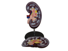 XC310-2 Kidney Model 2 Parts